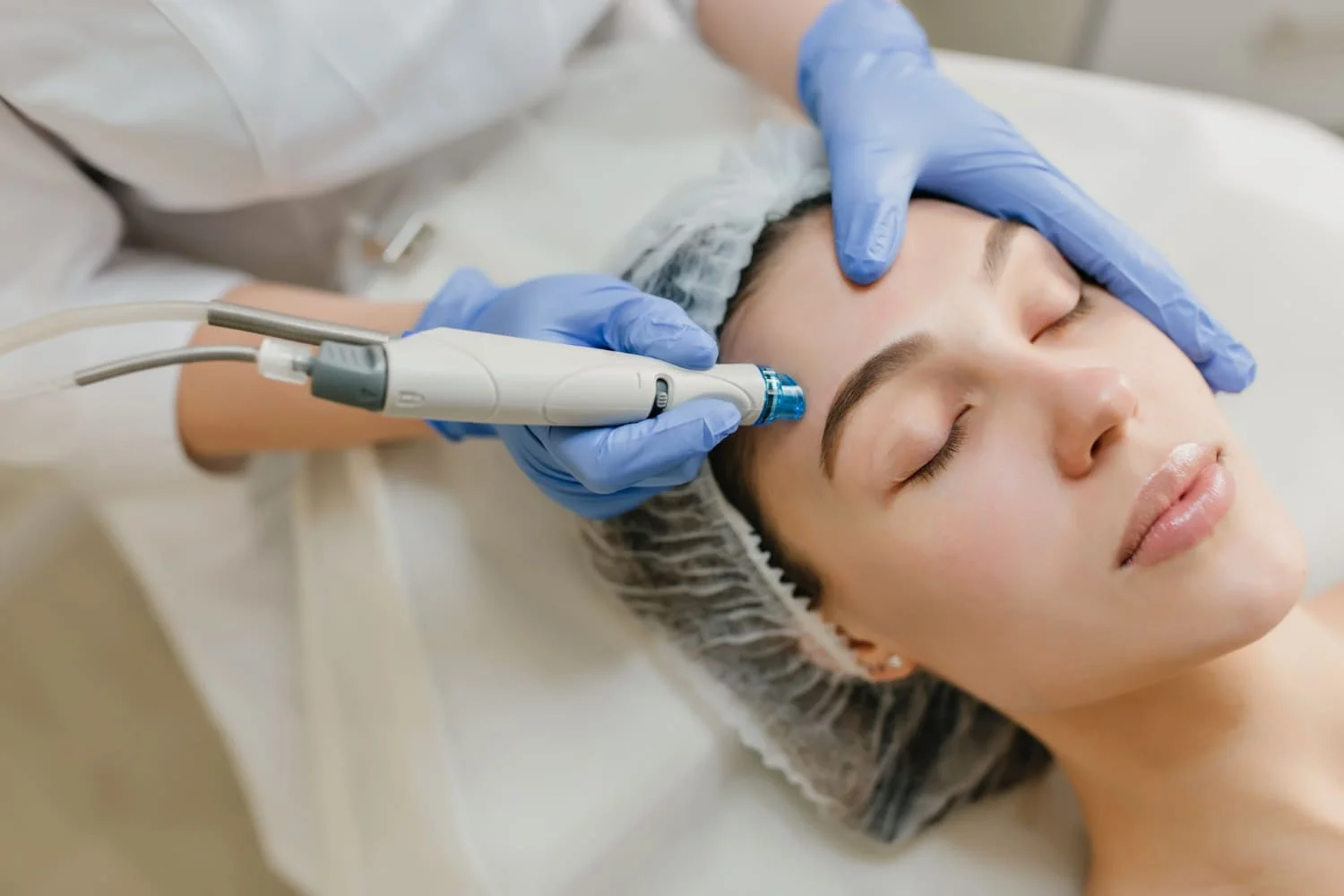 Dermapen Buenos Aires